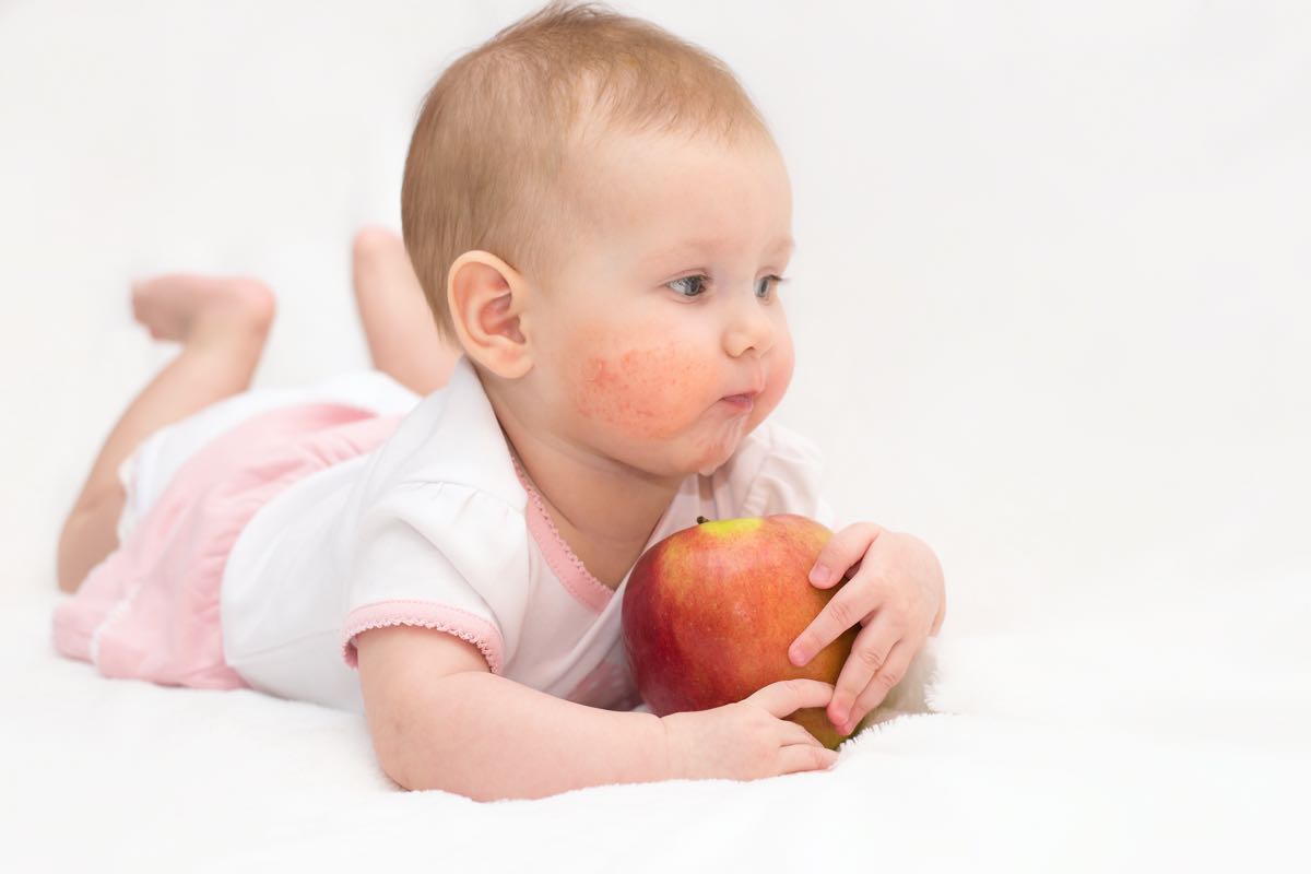 Is Your Toddler's Skin Telling You Something?